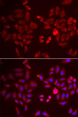 Immunofluorescence - PDK4 antibody (A3069)