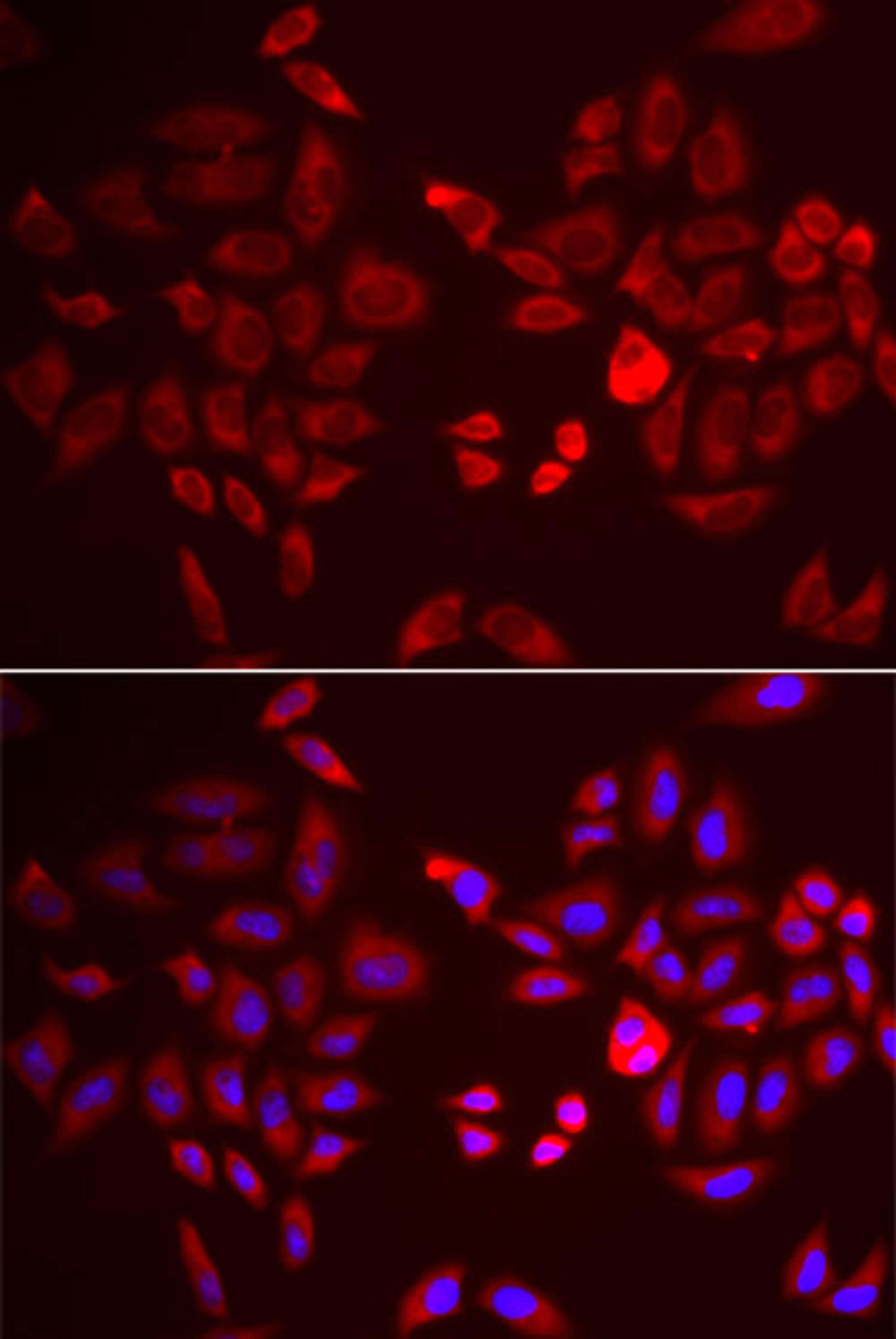 Immunofluorescence - PDK4 antibody (A3069)