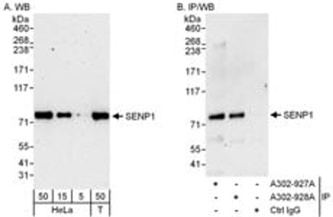 Detection of human SENP1 by western blot and immunoprecipitation.