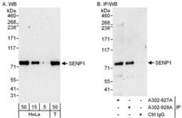 Detection of human SENP1 by western blot and immunoprecipitation.