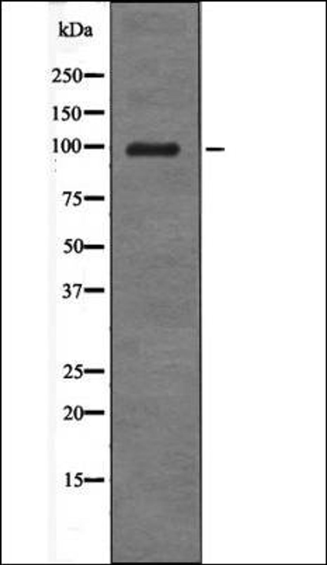 Western blot analysis of UV treated COS7 whole cell lysates using Androgen Receptor -Phospho-Tyr534- antibody