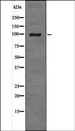 Western blot analysis of UV treated COS7 whole cell lysates using Androgen Receptor -Phospho-Tyr534- antibody