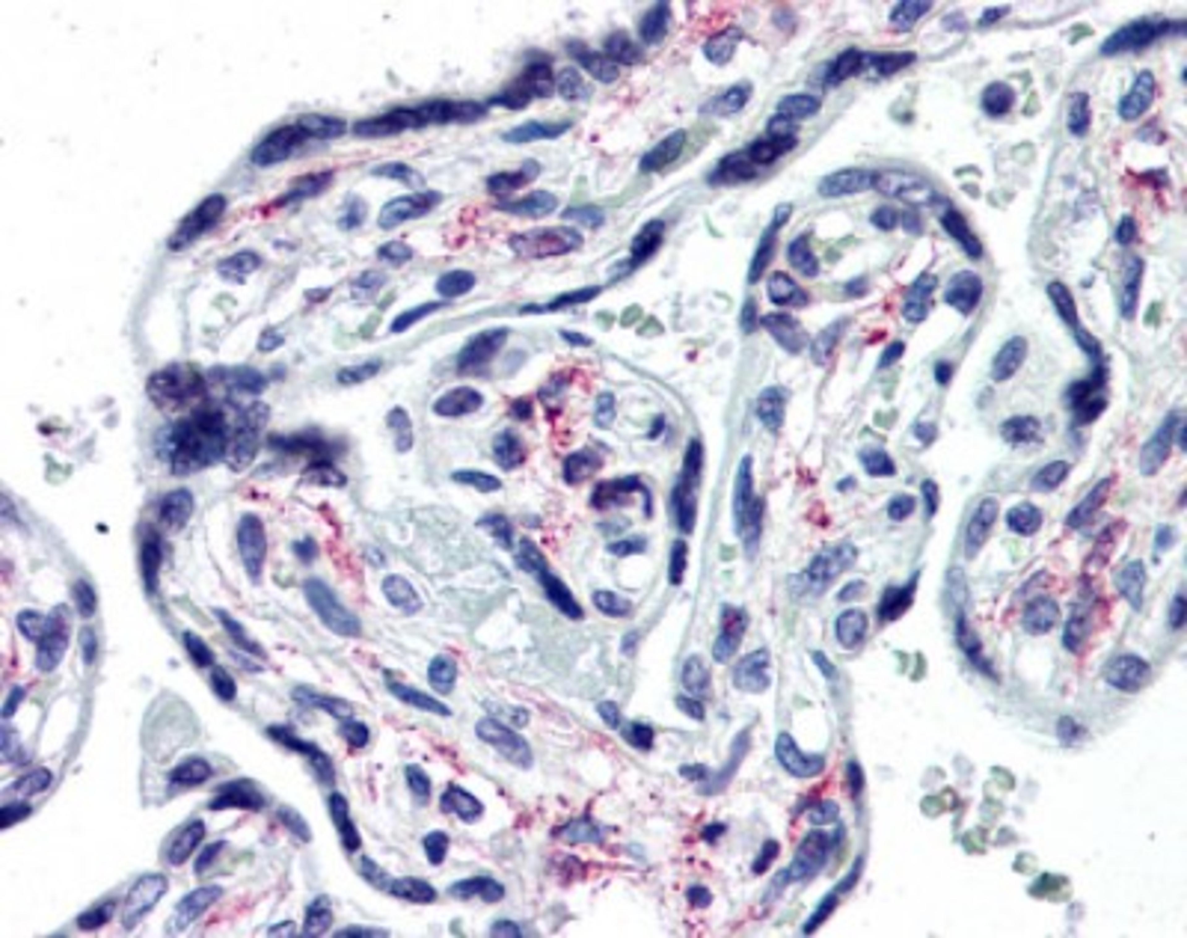 Immunohistochemistry-Paraffin: IL-1 RI Antibody (40101) [NBP1-50304] - Analysis of anti-IL1R1 antibody with human placenta at concentration 10 ug/ml.