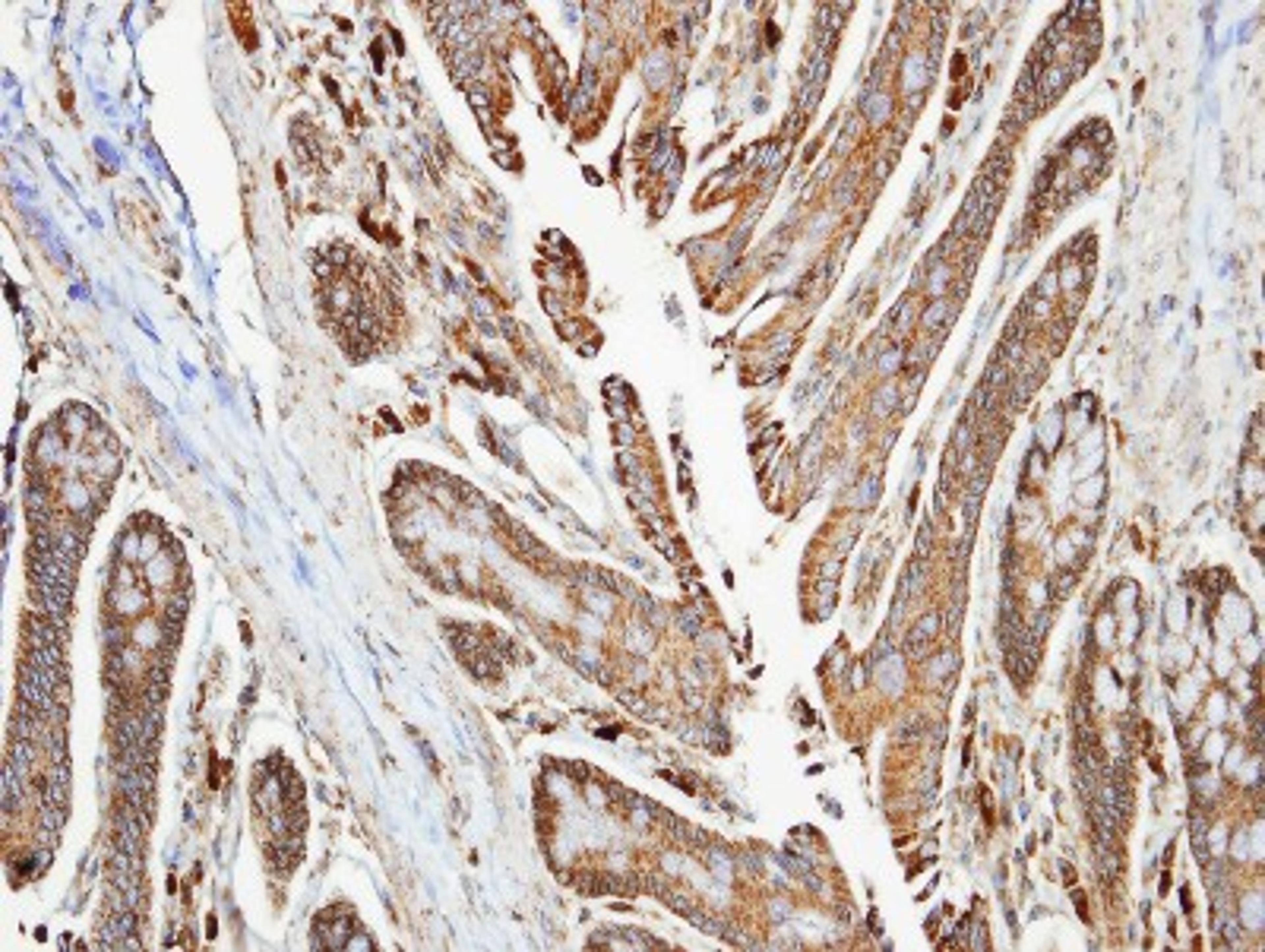 Immunohistochemistry-Paraffin: NDUFA10 Antibody [NBP1-32146] - Paraffin-embedded colon, using antibody at 1:100 dilution.