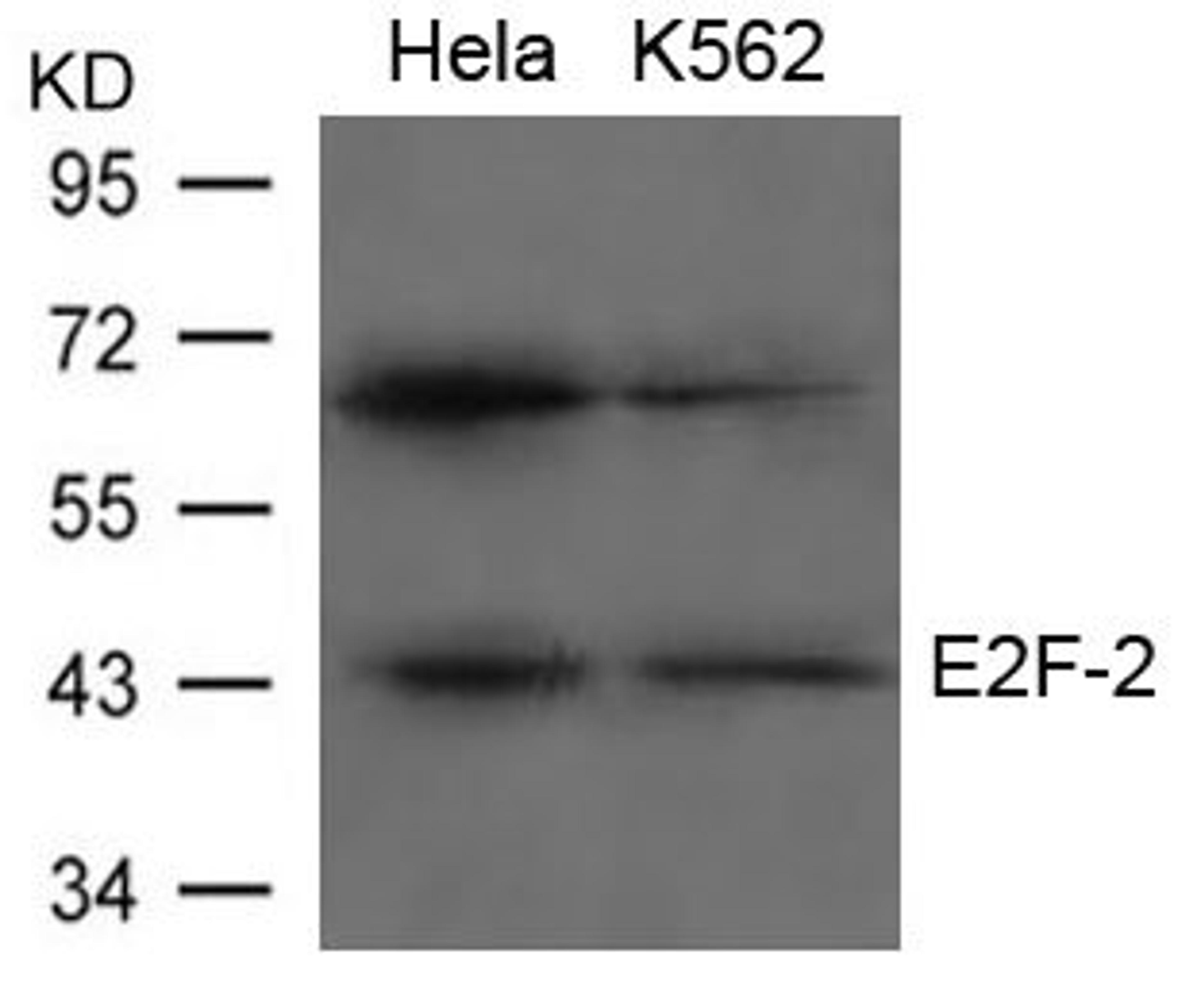 Western blot analysis of Hela and K562 cells using E2F-2 antibody