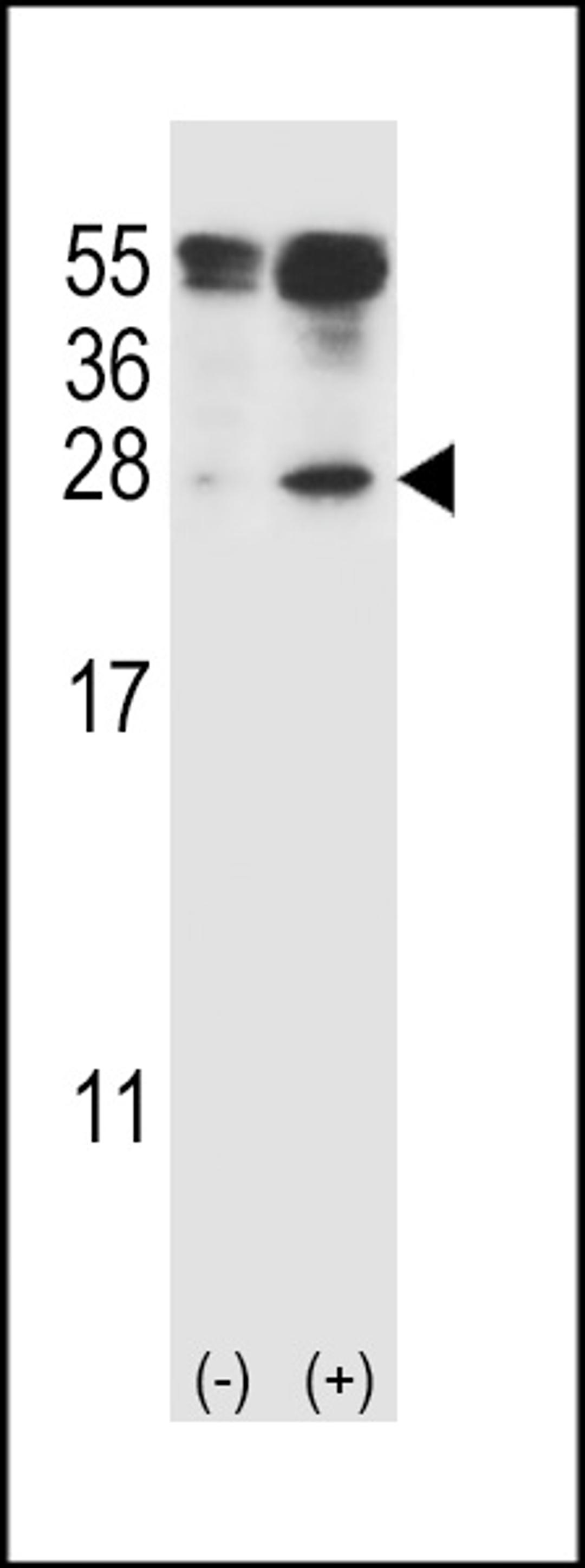 Western blot analysis of IL27 using rabbit polyclonal IL27 Antibody (C71) using 293 cell lysates (2 ug/lane) either nontransfected (Lane 1) or transiently transfected (Lane 2) with the IL27 gene.