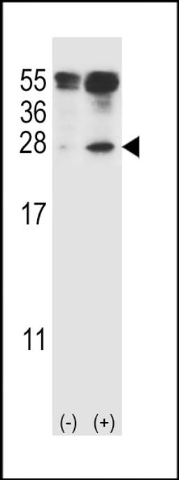 Western blot analysis of IL27 using rabbit polyclonal IL27 Antibody (C71) using 293 cell lysates (2 ug/lane) either nontransfected (Lane 1) or transiently transfected (Lane 2) with the IL27 gene.