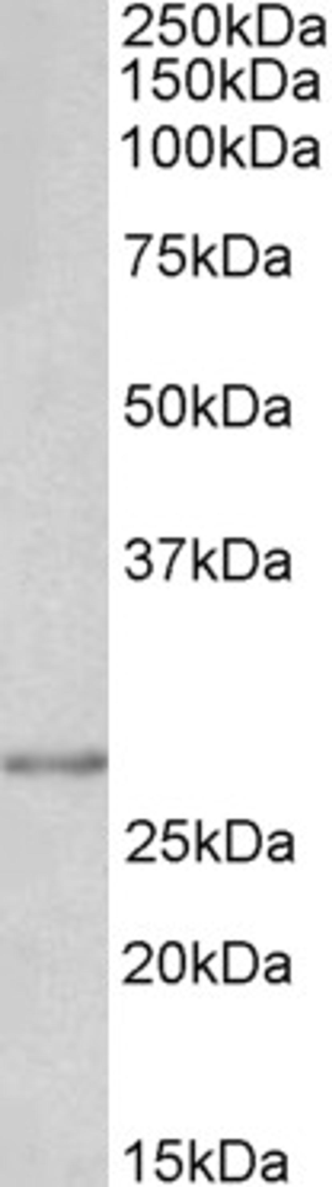 46-392 (0.1ug/ml) staining of A431 lysate (35ug protein in RIPA buffer). Detected by chemiluminescence.