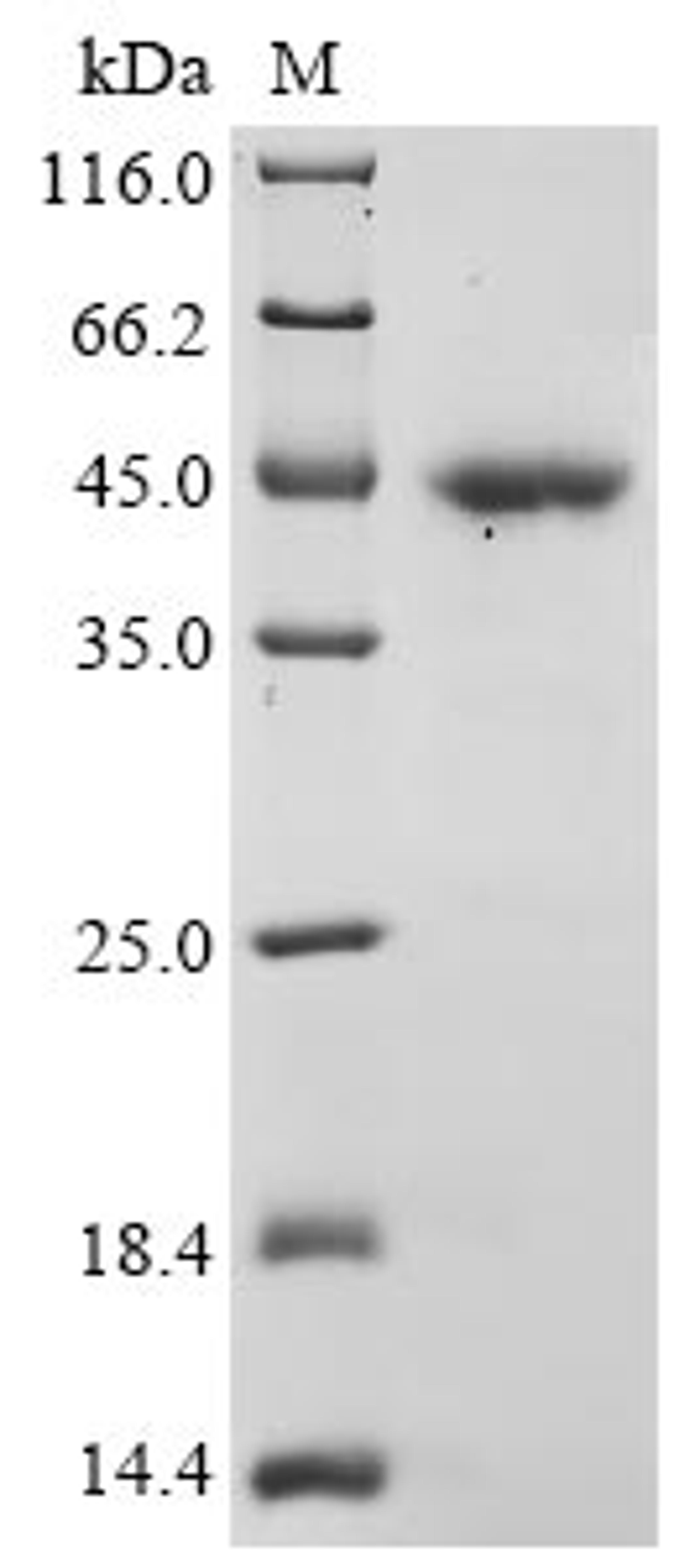 (Tris-Glycine gel) Discontinuous SDS-PAGE (reduced) with 5% enrichment gel and 15% separation gel.