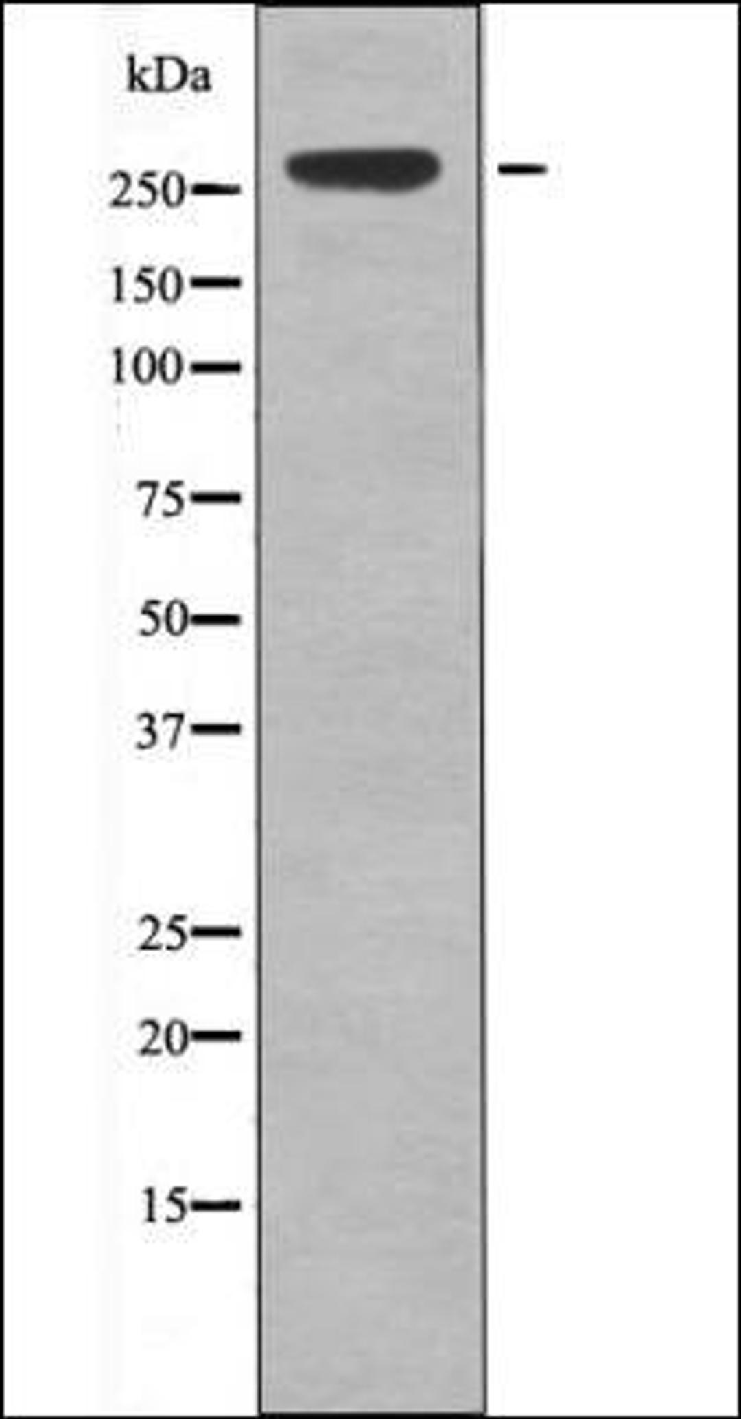 Western blot analysis of EGF treated 293 whole cell lysates using IGF2R -Phospho-Ser2484- antibody