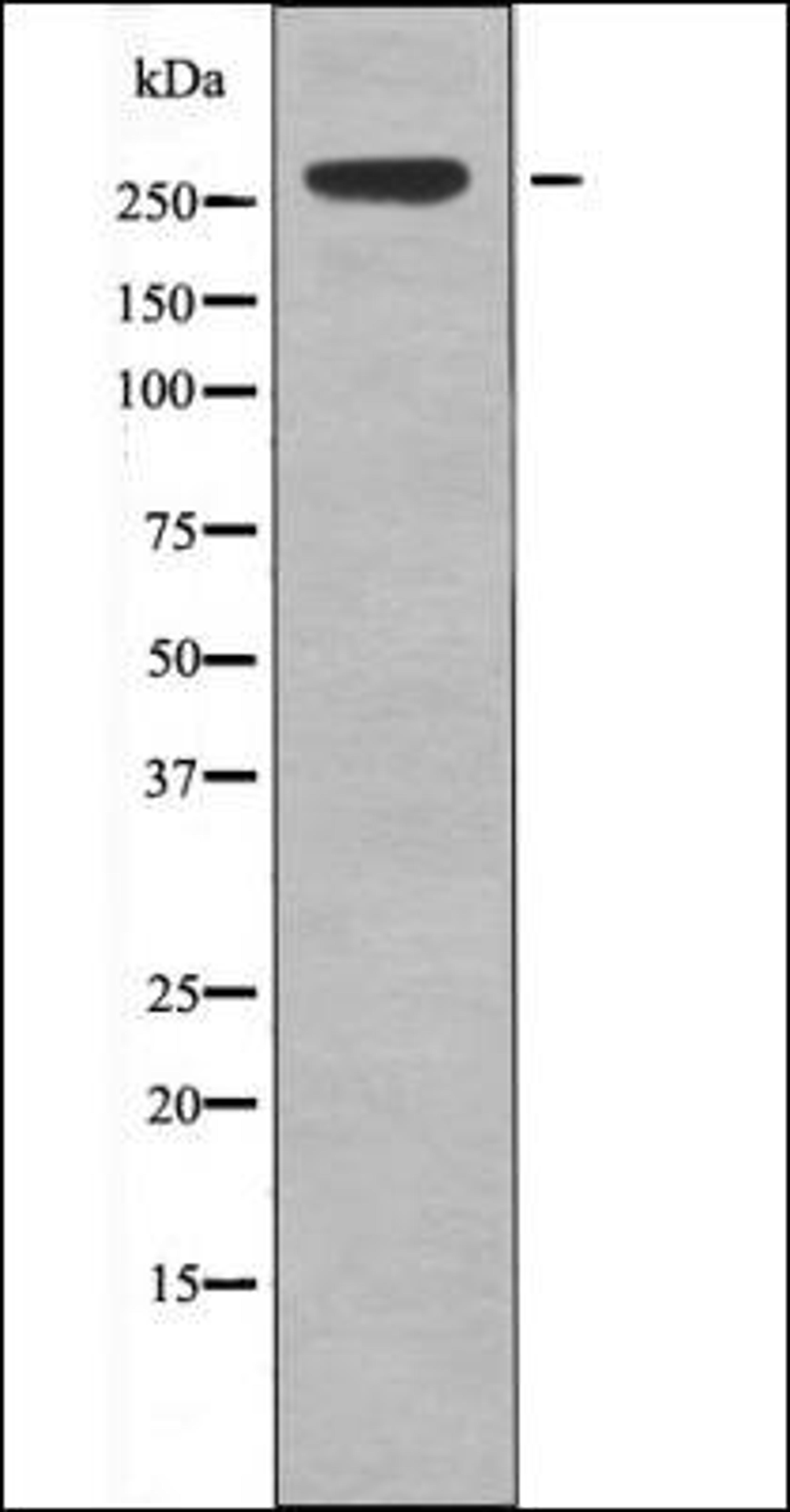 Western blot analysis of EGF treated 293 whole cell lysates using IGF2R -Phospho-Ser2484- antibody