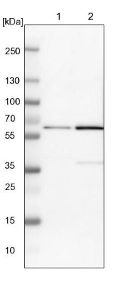 Western Blot: YARS Antibody [NBP1-86889] - Lane 1: NIH-3T3 cell lysate (Mouse embryonic fibroblast cells)<br/>Lane 2: NBT-II cell lysate (Rat Wistar bladder tumour cells)