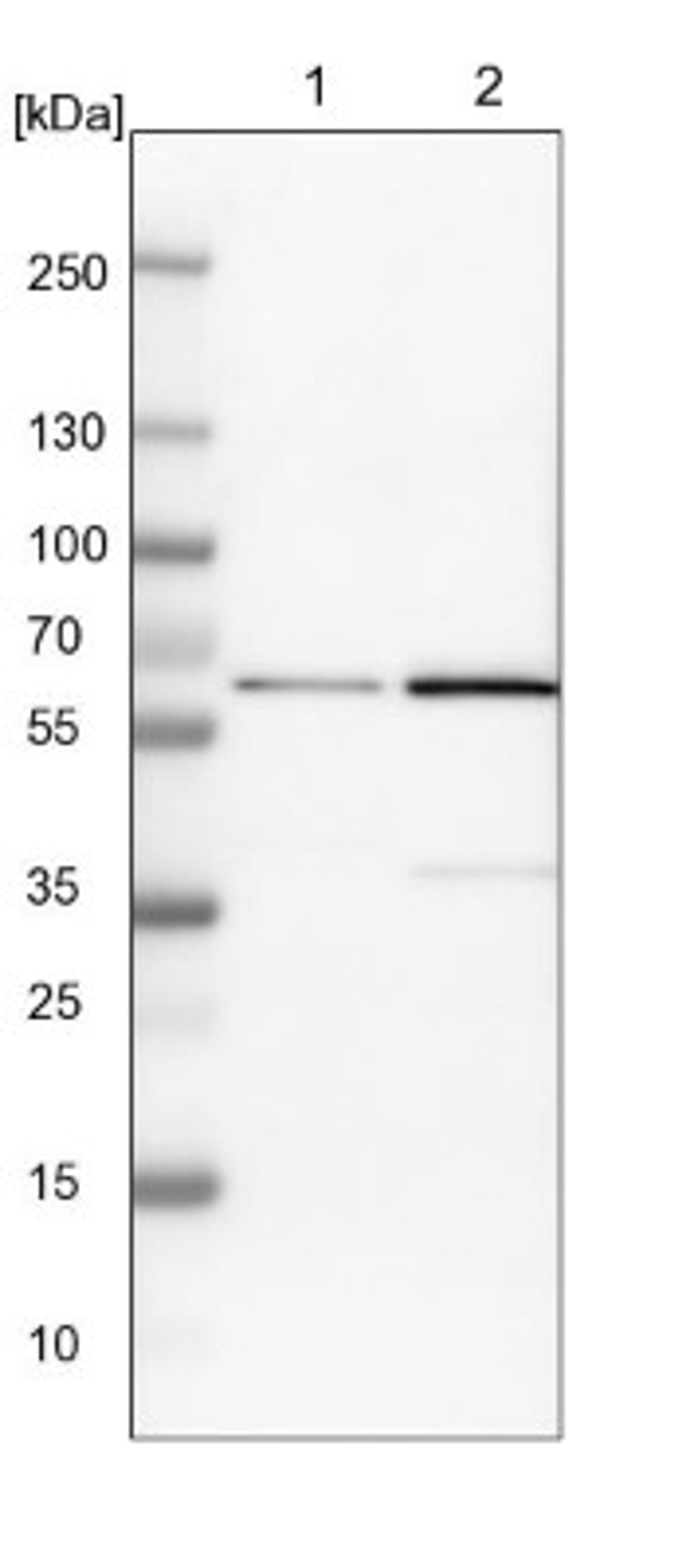 Western Blot: YARS Antibody [NBP1-86889] - Lane 1: NIH-3T3 cell lysate (Mouse embryonic fibroblast cells)<br/>Lane 2: NBT-II cell lysate (Rat Wistar bladder tumour cells)