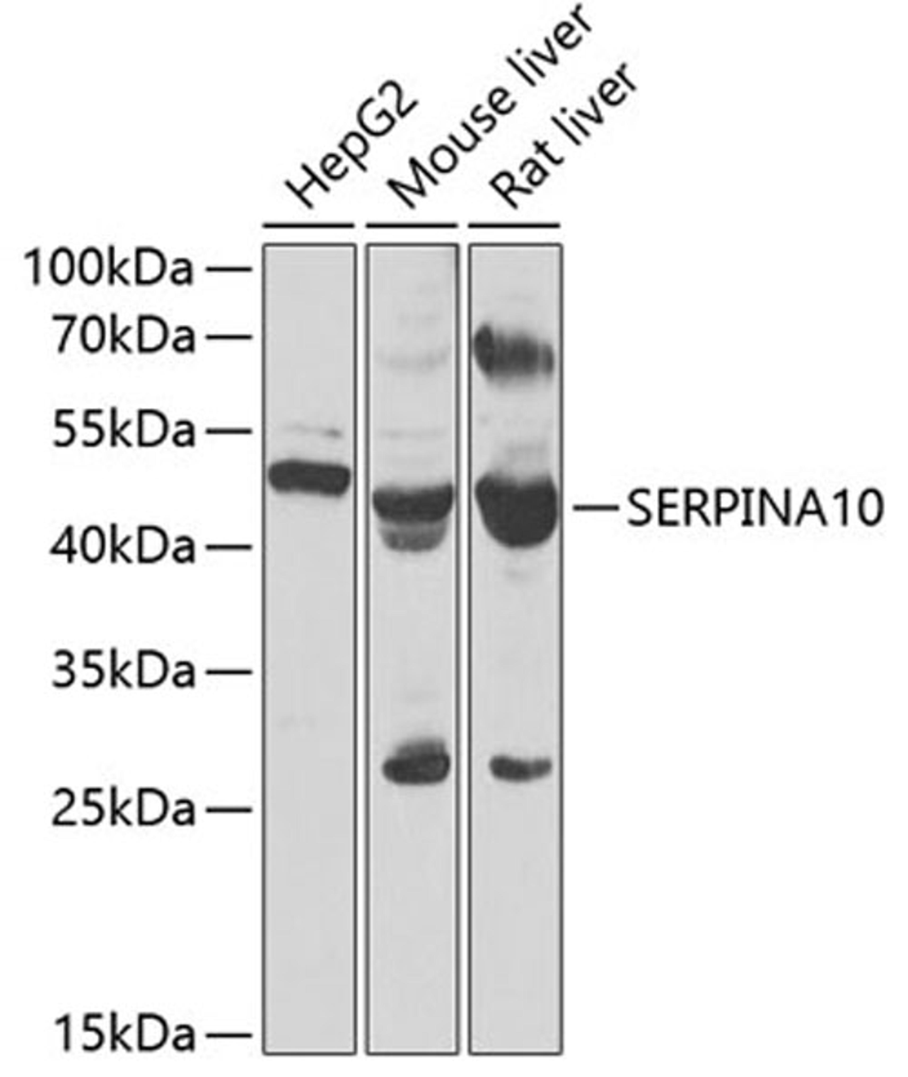 Western blot - SERPINA10 antibody (A7106)