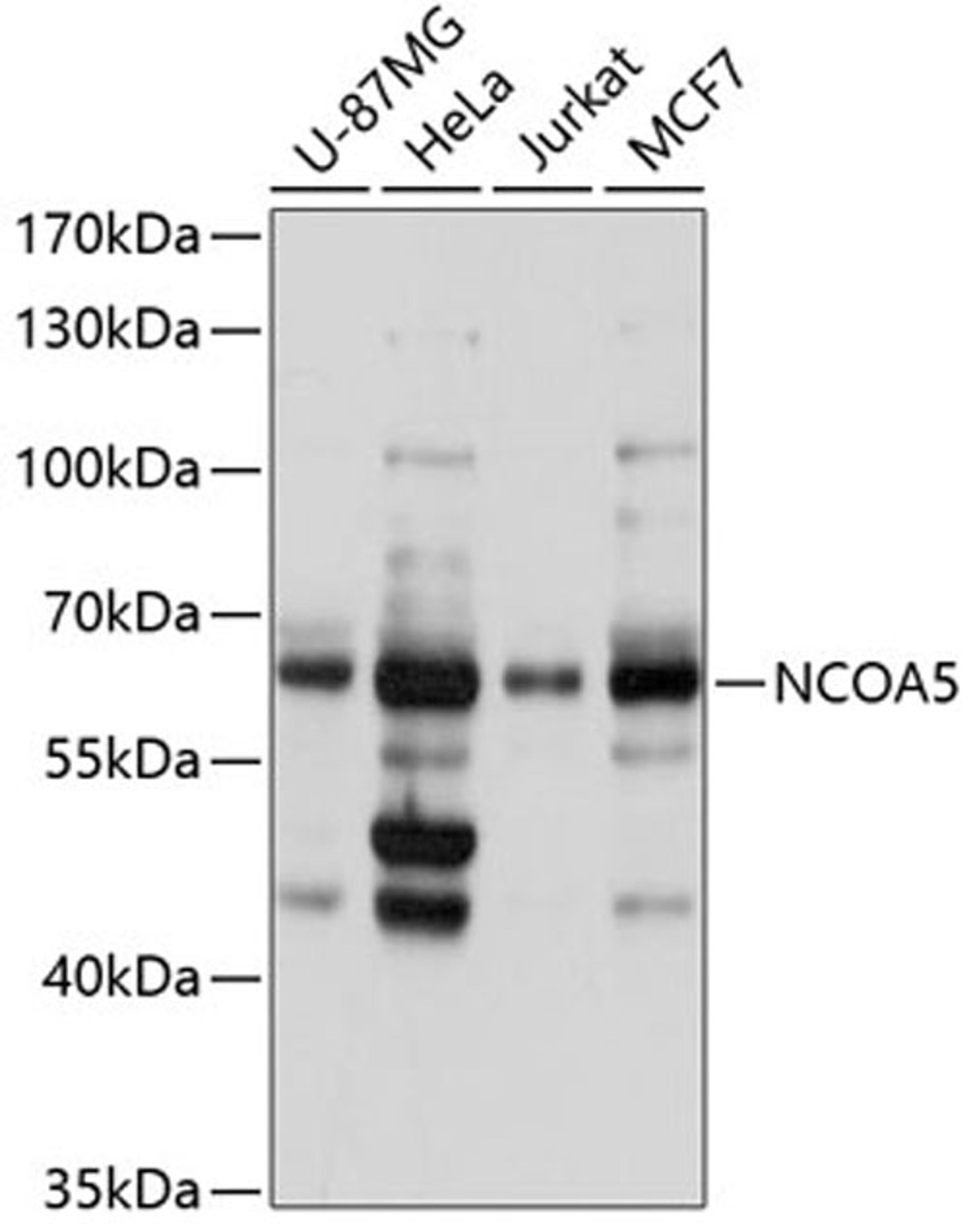 Western blot - NCOA5 antibody (A3476)
