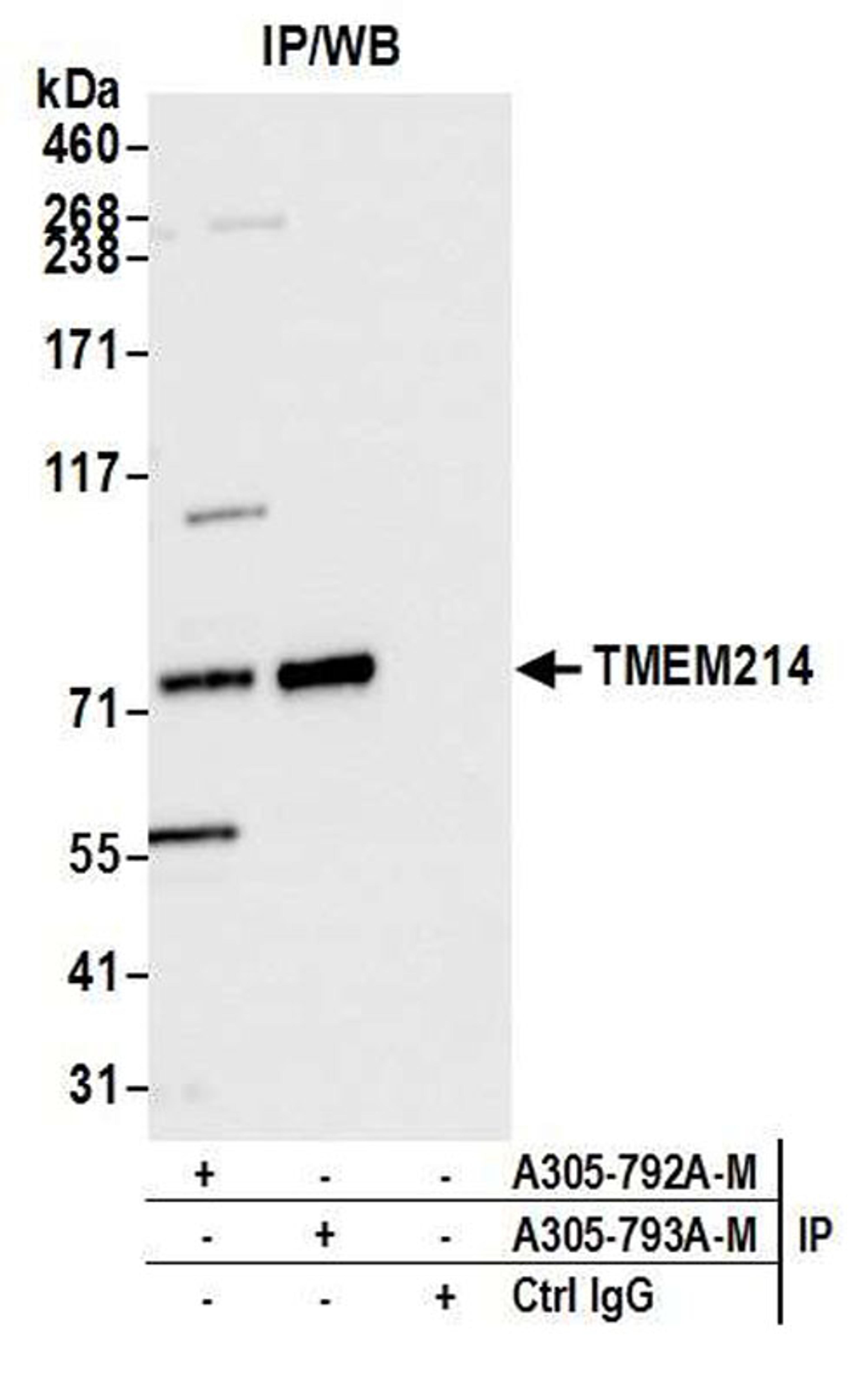 Detection of human TMEM214 by WB of IP.