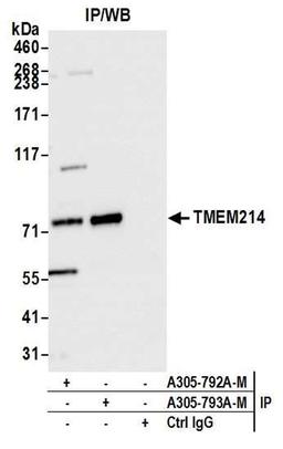Detection of human TMEM214 by WB of IP.