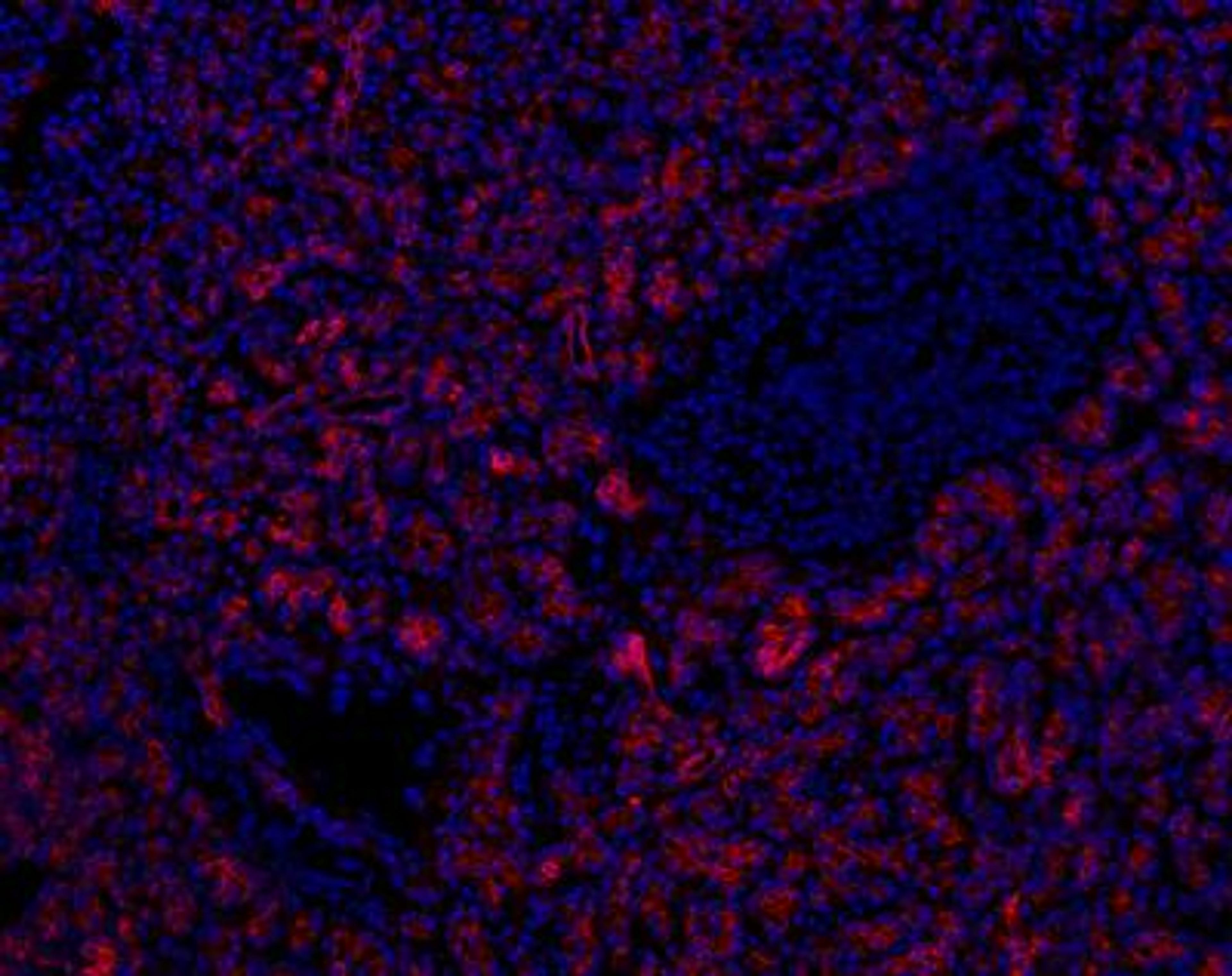 Immunocytochemistry/Immunofluorescence: SLC28A3 Antibody [NBP1-84418] - NBP1-84418 on human pancreas cryosection (100x). Ducts and acinar cells (but not islets) are strongly labeled. Image from verified customer review.