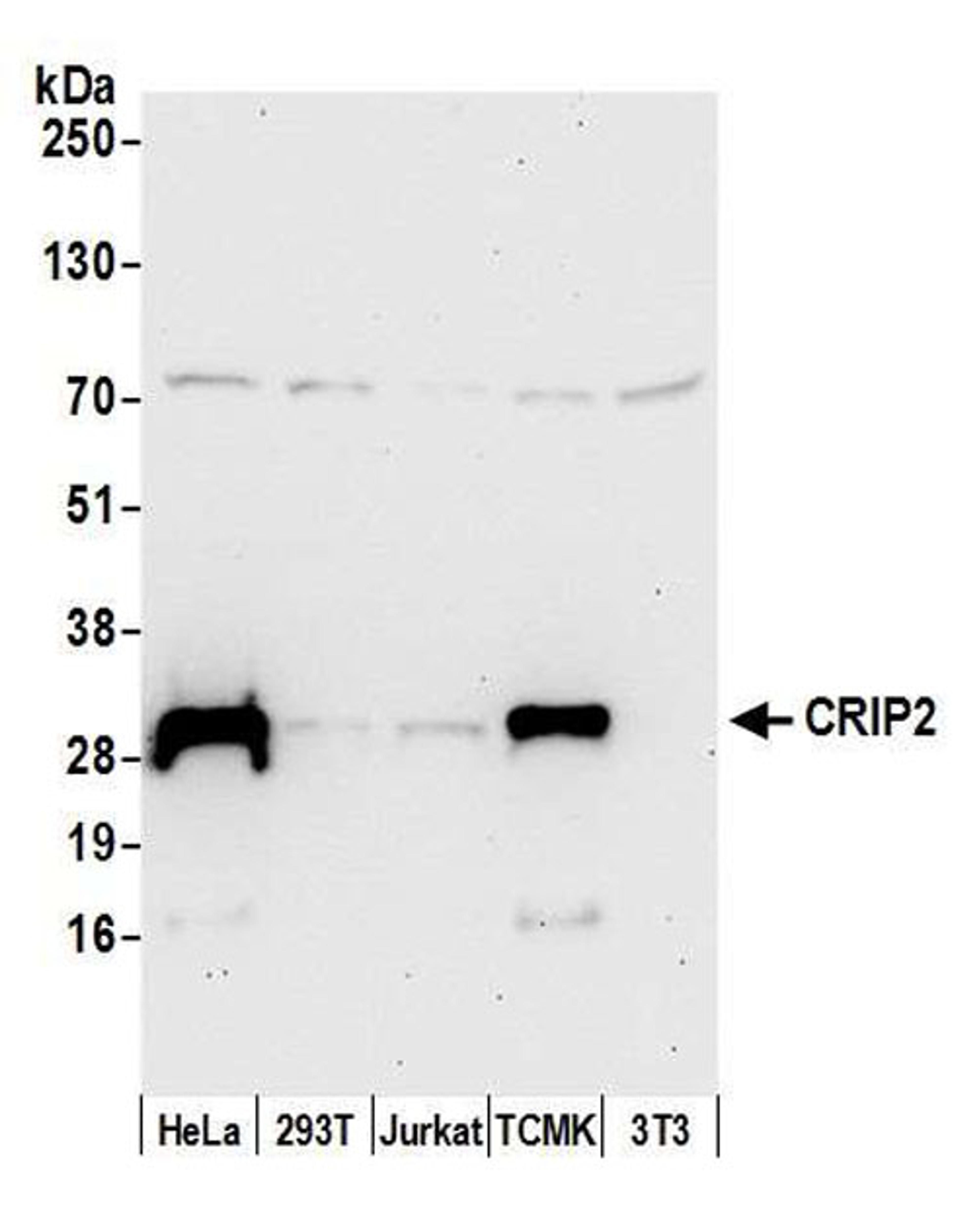 Detection of human and mouse CRIP2 by WB.