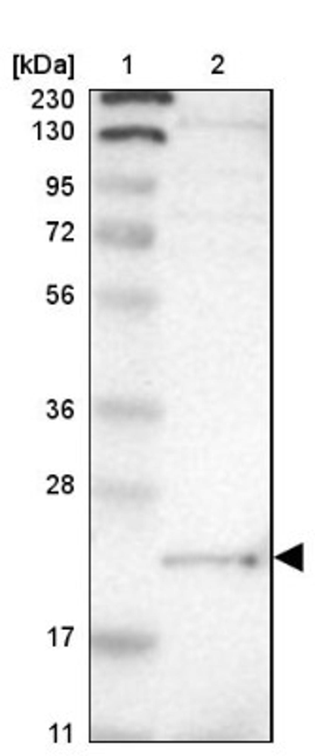 Western Blot: LITAF Antibody [NBP1-83473] - Lane 1: Marker [kDa] 230, 130, 95, 72, 56, 36, 28, 17, 11<br/>Lane 2: Human cell line RT-4