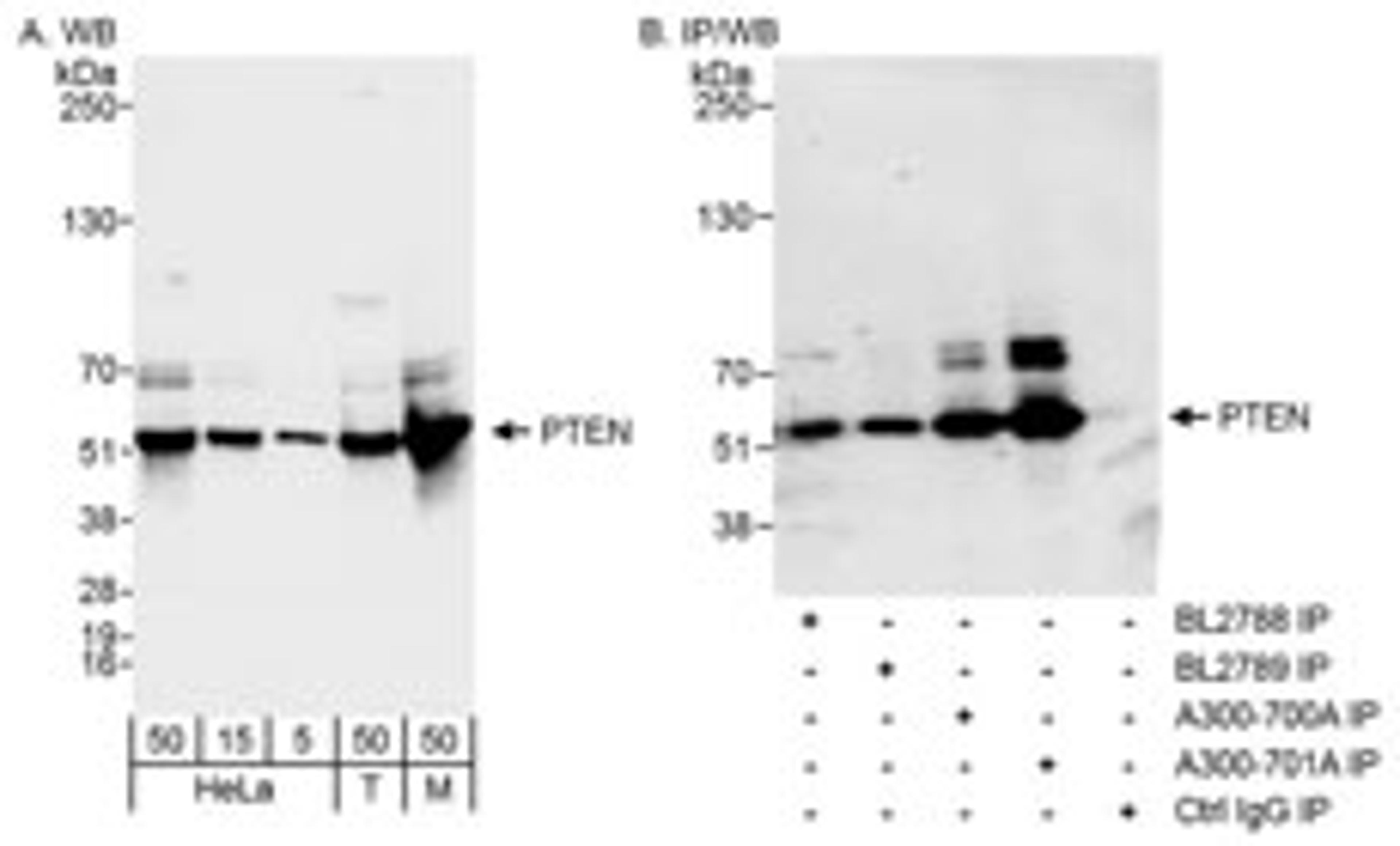 Detection of human and mouse PTEN by western blot (h&m) and immunoprecipitation (h).