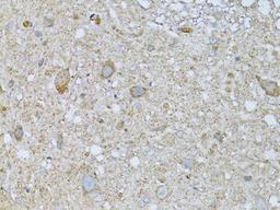 Immunohistochemistry  - PHLDA2 antibody (A13924)