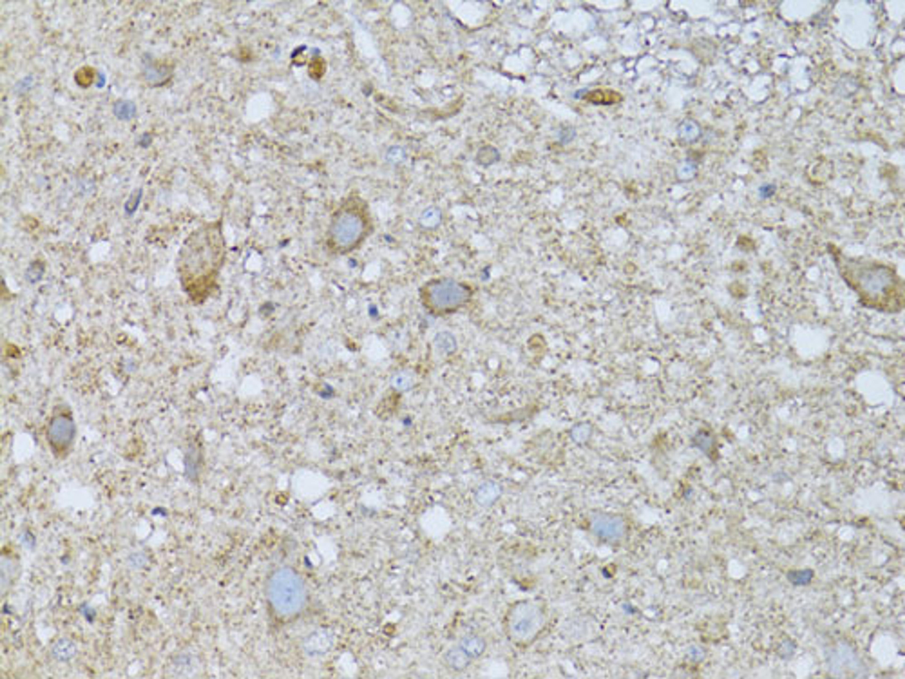 Immunohistochemistry - PHLDA2 antibody (A13924)