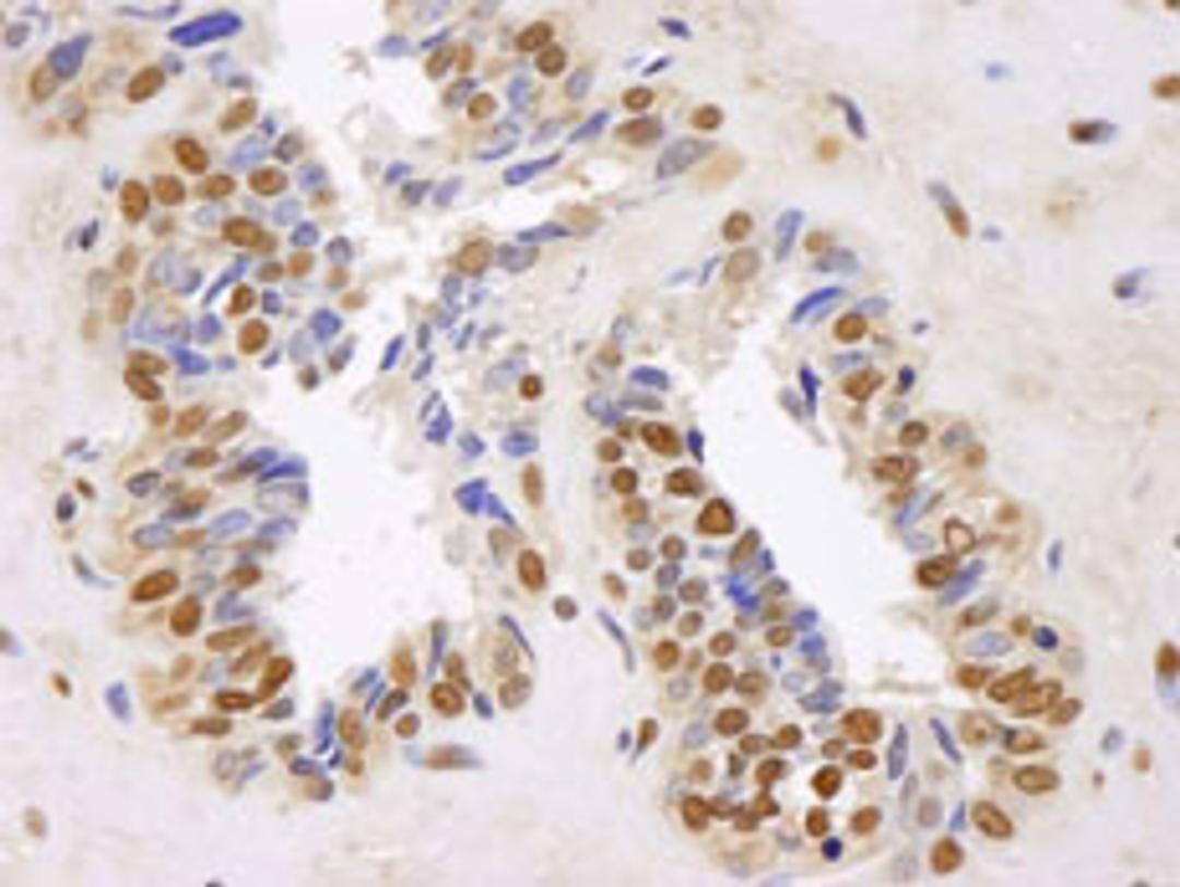 Detection of human GAPDH by immunohistochemistry.