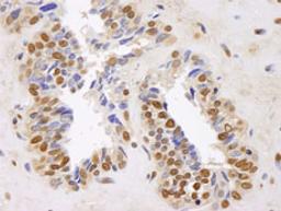 Detection of human GAPDH by immunohistochemistry.