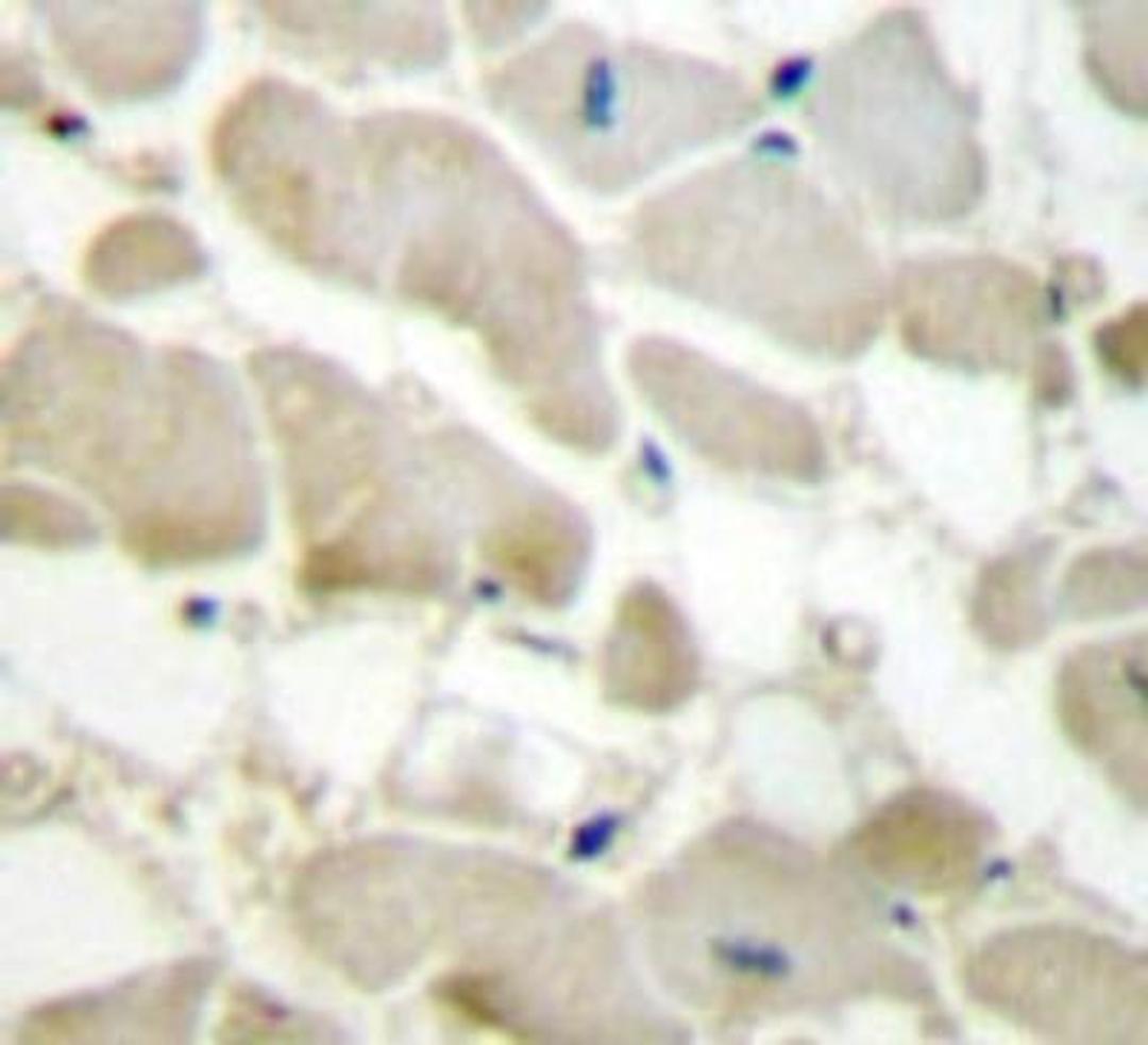 Immunohistochemistry-Paraffin: Collagen V Antibody [NBP1-19633] - Paraffin-embedded human heart tissue.