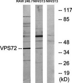 Western blot analysis of extracts from RAW264.7 cells and NIH/3T3 cells using VPS72 antibody