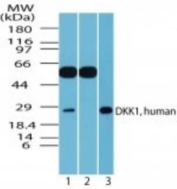 Western Blot: Dkk-1 Antibody [NBP2-24701] - Analysis of human Dkk-1 in A549 cell lysate in the 1) absence and 2) presence of immunizing peptide, and 3) RAW using NBP2-24701 at 1 ug/ml.