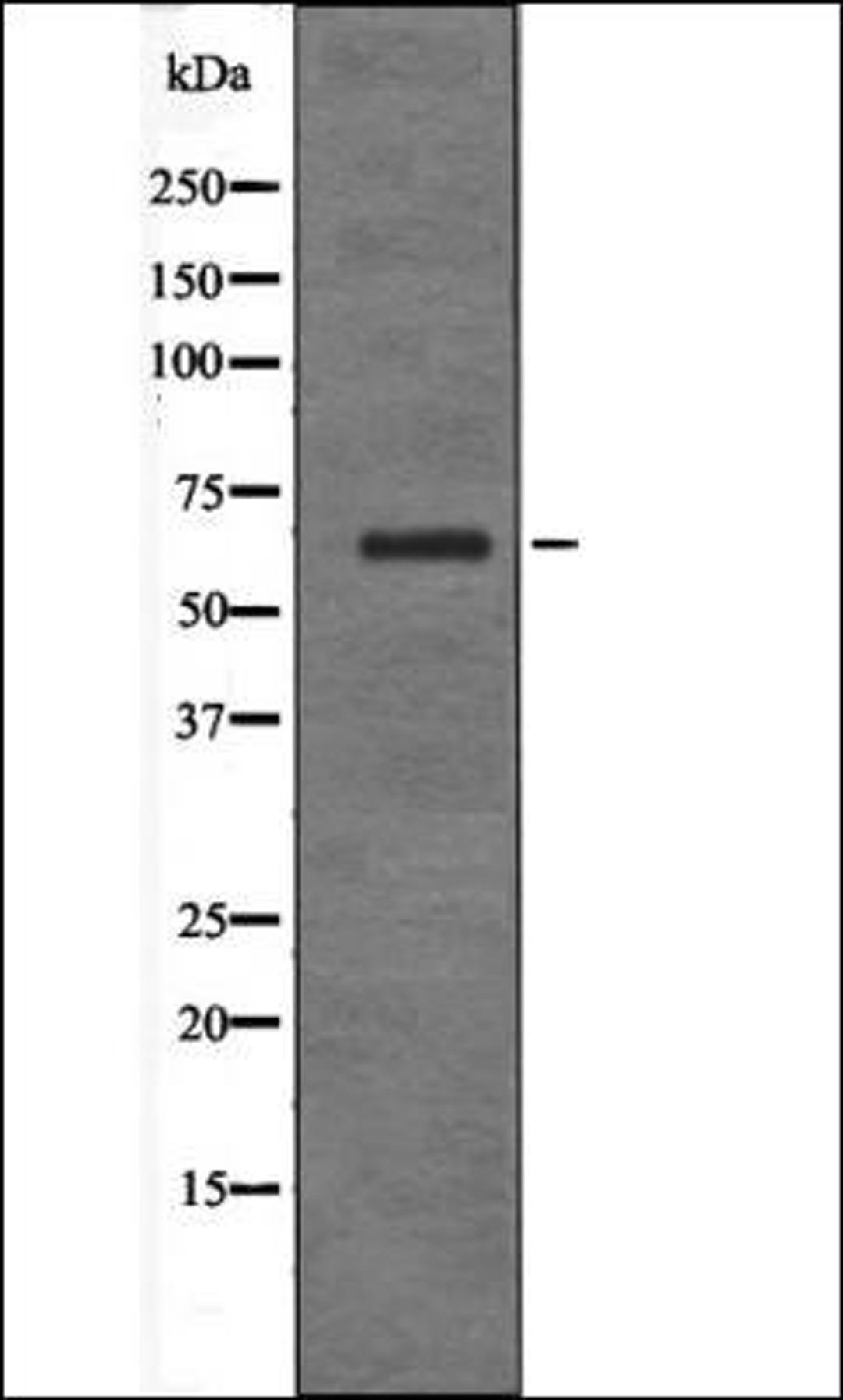 Western blot analysis of 293 whole cell lysates using IFNAR1 -Phospho-Ser535- antibody