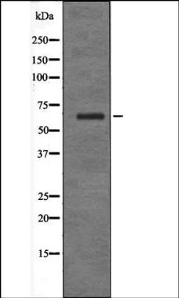 Western blot analysis of 293 whole cell lysates using IFNAR1 -Phospho-Ser535- antibody