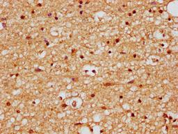 IHC image of CSB-PA897521LA01HU diluted at 1:200 and staining in paraffin-embedded human brain tissue performed on a Leica BondTM system. After dewaxing and hydration, antigen retrieval was mediated by high pressure in a citrate buffer (pH 6.0). Section was blocked with 10% normal goat serum 30min at RT. Then primary antibody (1% BSA) was incubated at 4&deg;C overnight. The primary is detected by a biotinylated secondary antibody and visualized using an HRP conjugated SP system.