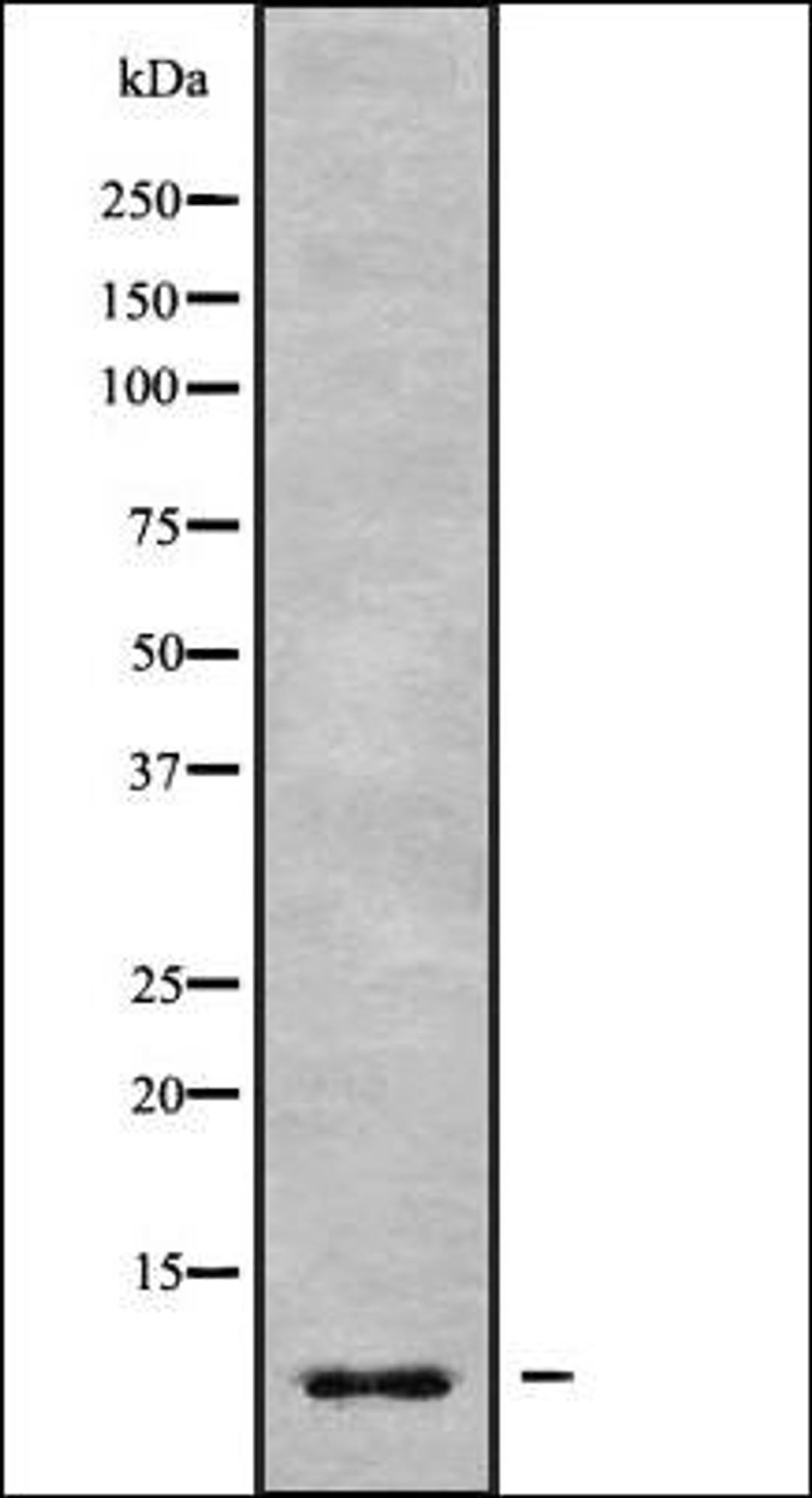 Western blot analysis of Jurkat whole cell lysates using GNG7 antibody