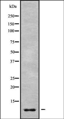 Western blot analysis of Jurkat whole cell lysates using GNG7 antibody