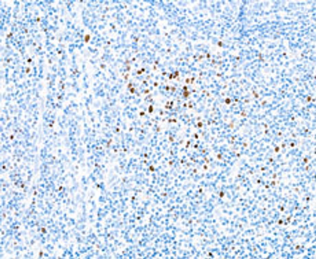 Detection of human EOMES in tonsil by IHC.