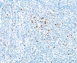 Detection of human EOMES in tonsil by IHC.