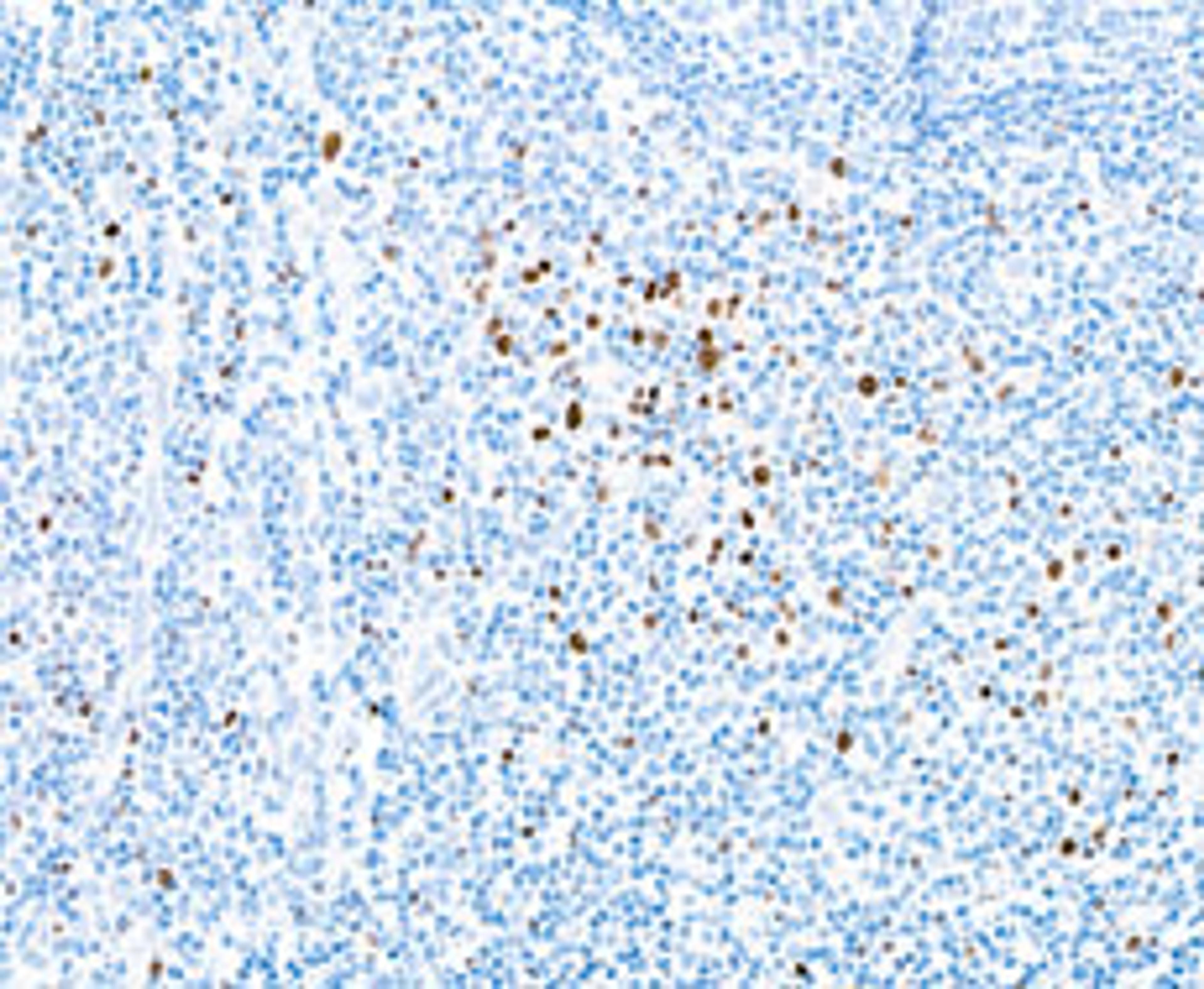 Detection of human EOMES in tonsil by IHC.