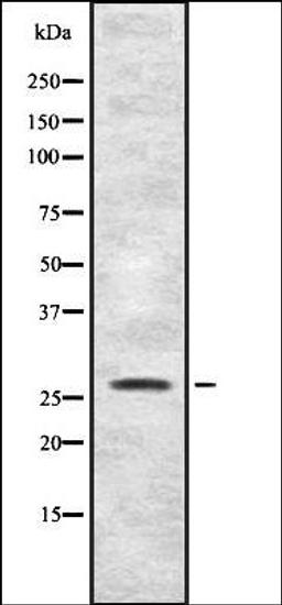 Western blot analysis of HEK293 cells using FGFP1 antibody