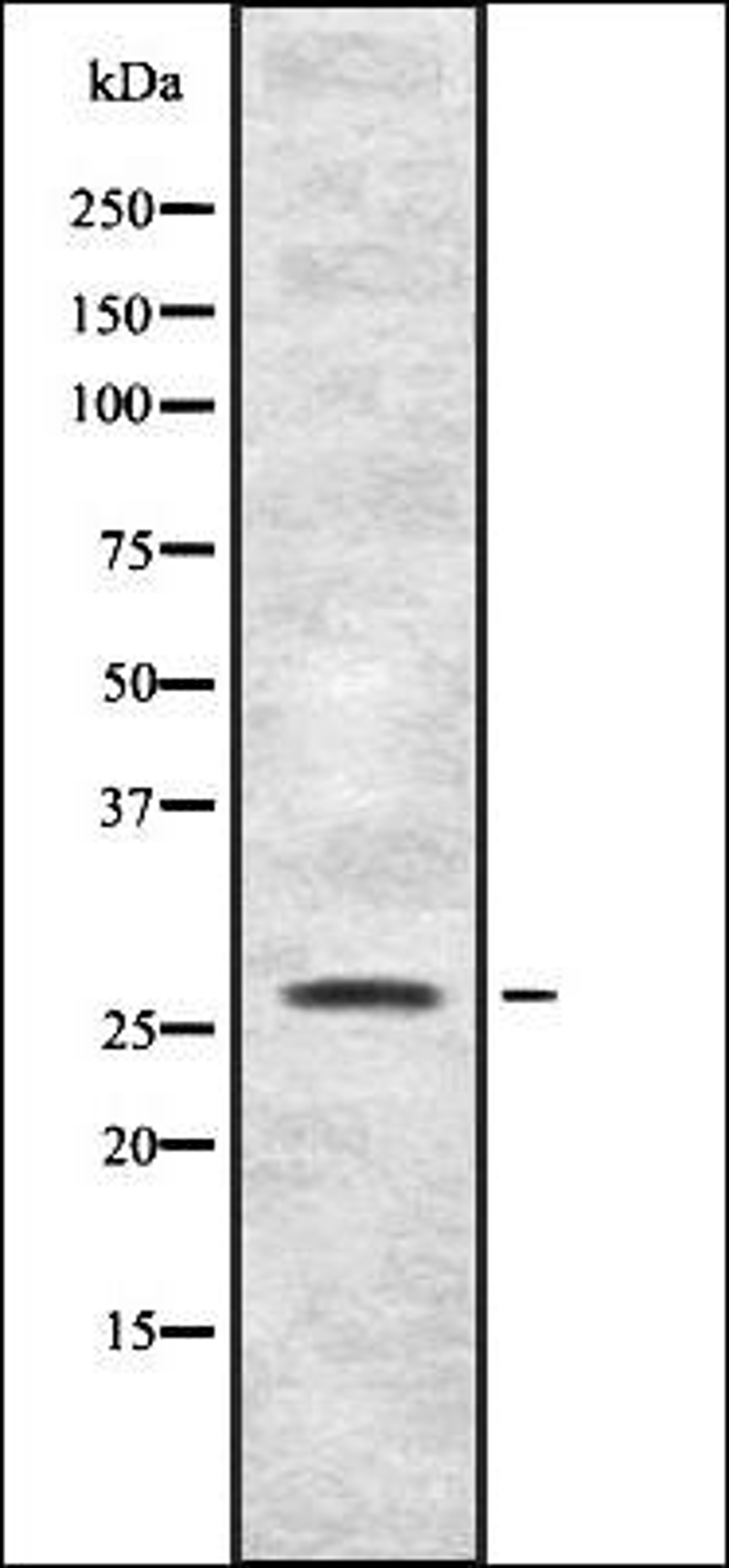 Western blot analysis of HEK293 cells using FGFP1 antibody