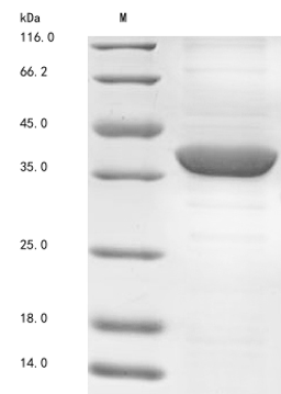 (Tris-Glycine gel) Discontinuous SDS-PAGE (reduced) with 5% enrichment gel and 15% separation gel.