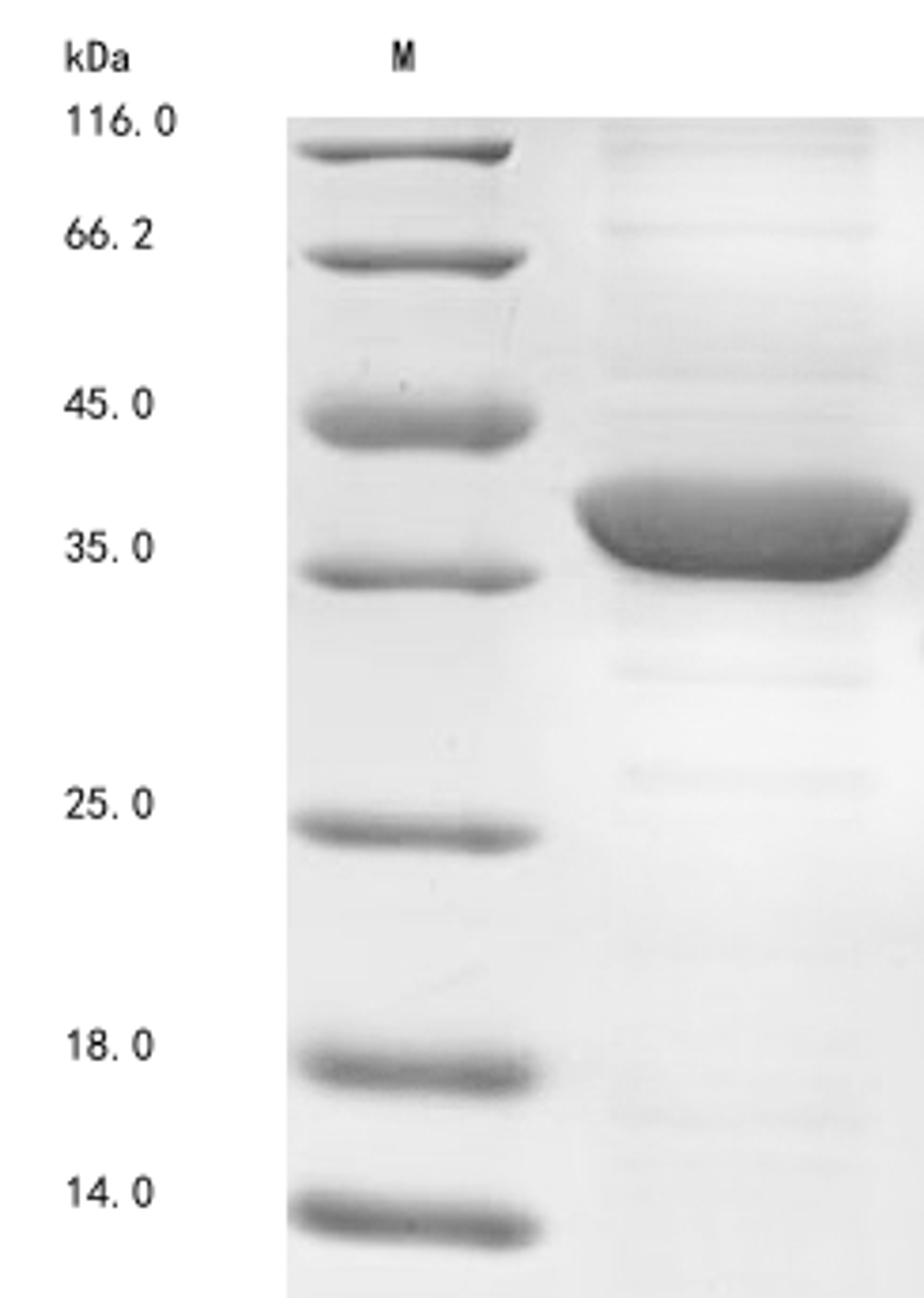 (Tris-Glycine gel) Discontinuous SDS-PAGE (reduced) with 5% enrichment gel and 15% separation gel.