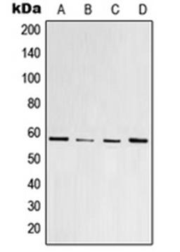 Western blot analysis of HeLa colchicine-treated (Lane 1), Raw264.7 colchicine-treated (Lane 2), PC12 colchicine-treated (Lane 3), U937 (Lane 4) whole cell lysates using PPARG antibody