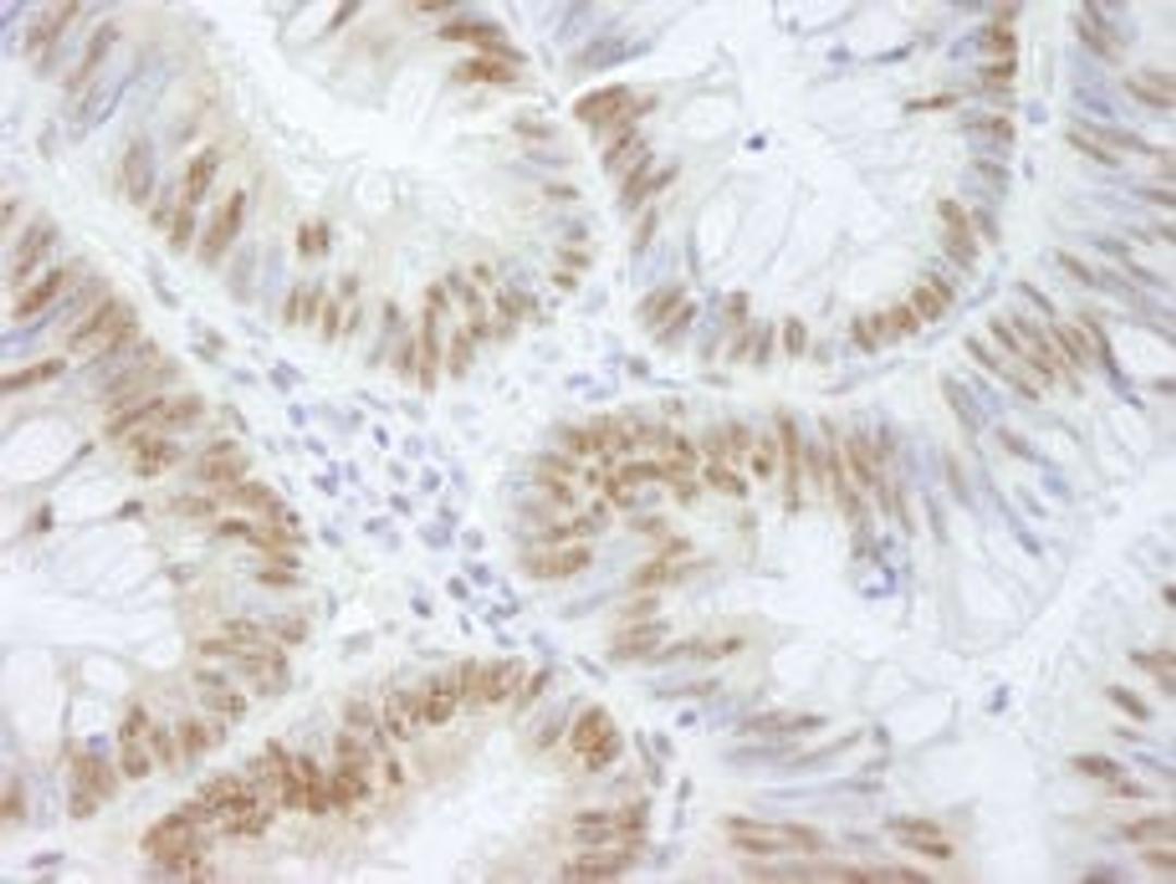 Detection of human AKAP8/AKAP95 by immunohistochemistry.