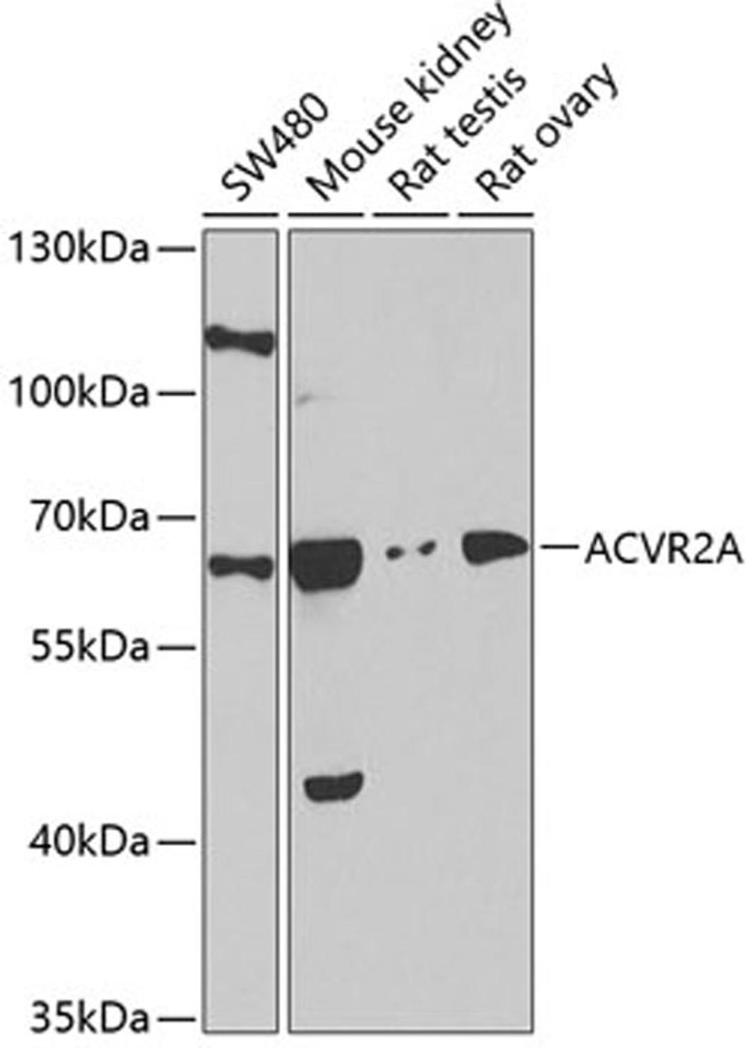 Western blot - ACVR2A antibody (A1981)