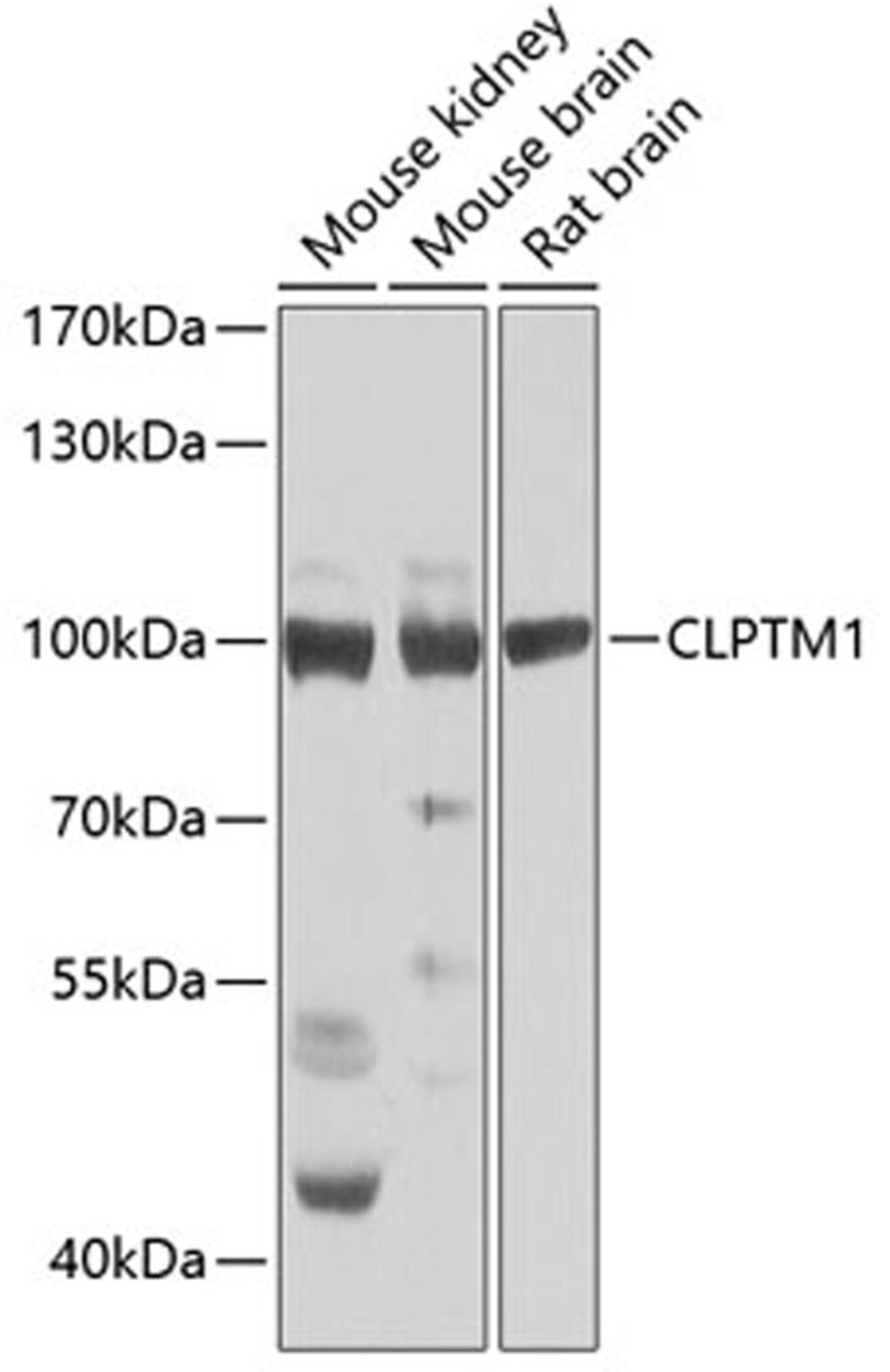 Western blot - CLPTM1 Antibody (A7656)