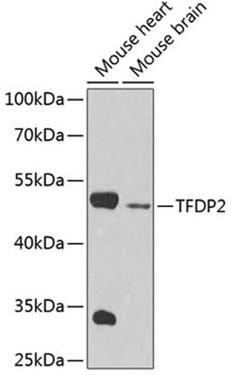 Western blot - TFDP2 antibody (A4152)