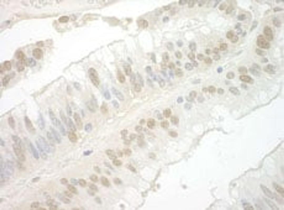 Detection of human Importin 7 by immunohistochemistry.